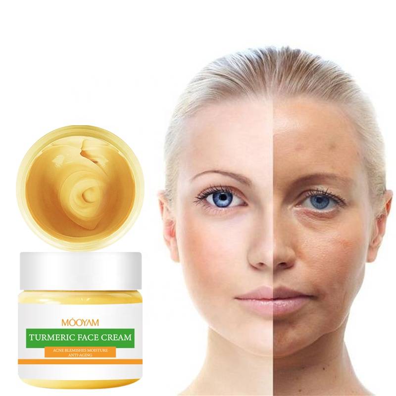 Private Label Skin Care Pimple Remover Face Cream Acne Treatment Whitening Dark Spot Removal Anti-aging Turmeric Cream